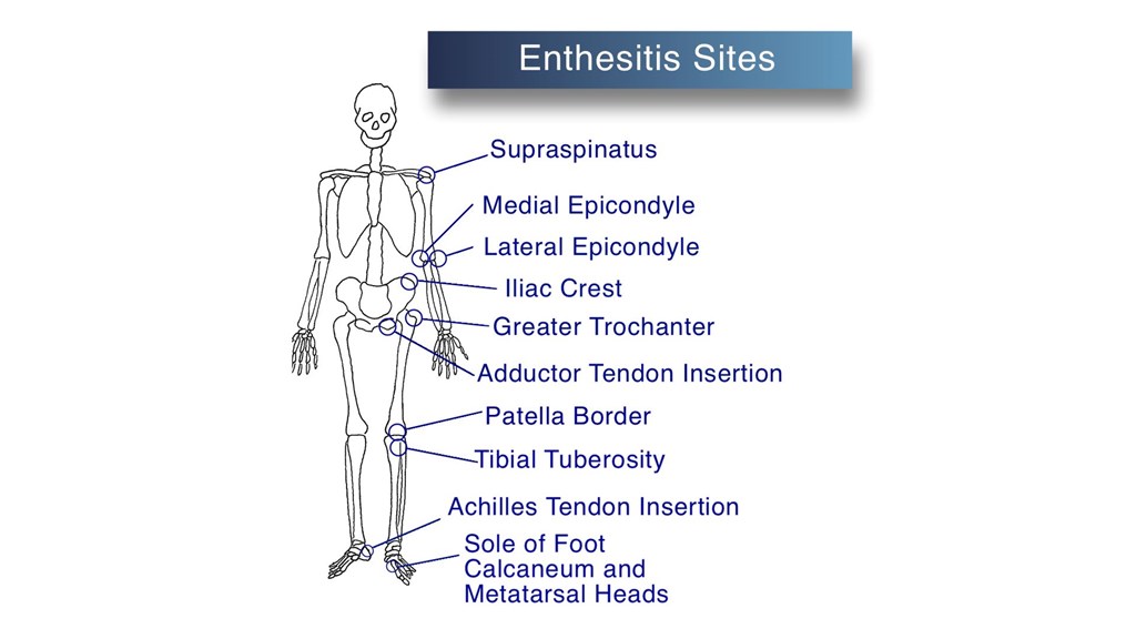 Surface Anatomy | Nurse - PMM