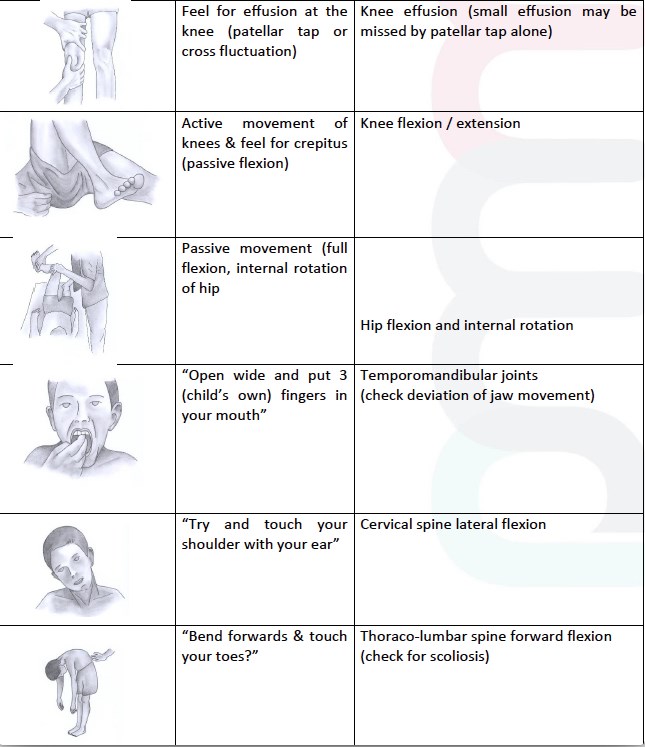 PGALS Steps (graphic) | Doctor - PMM