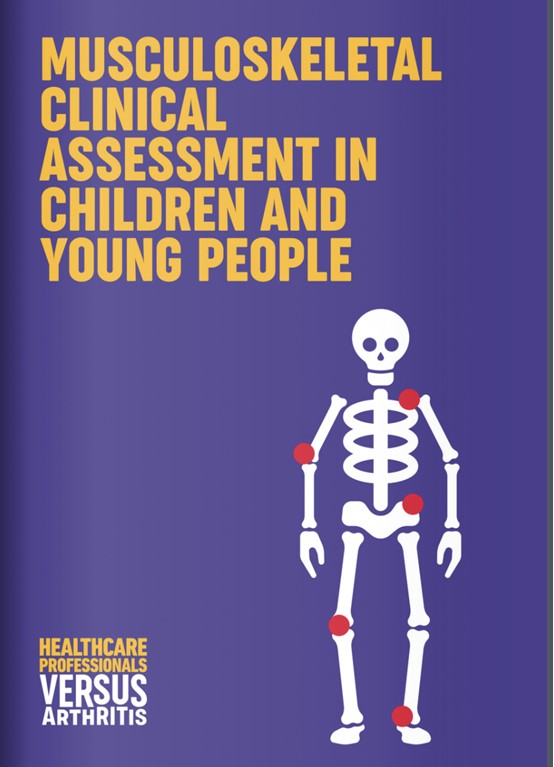 PGALS (paediatric Gait Arms Legs Spine) | Doctor - PMM